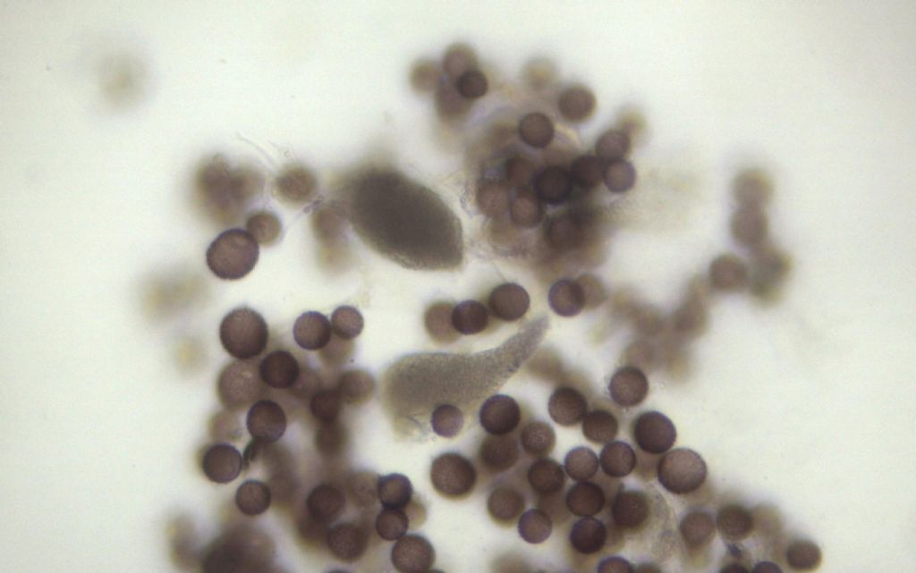 Physarum conglomeratum